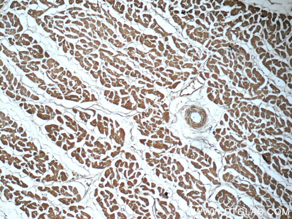 IHC staining of human heart using 60357-1-Ig (same clone as 60357-1-PBS)