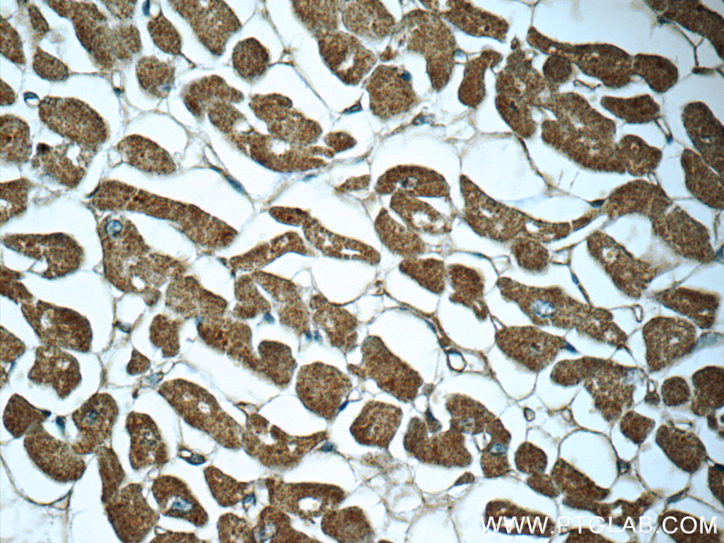 IHC staining of human heart using 60357-1-Ig (same clone as 60357-1-PBS)