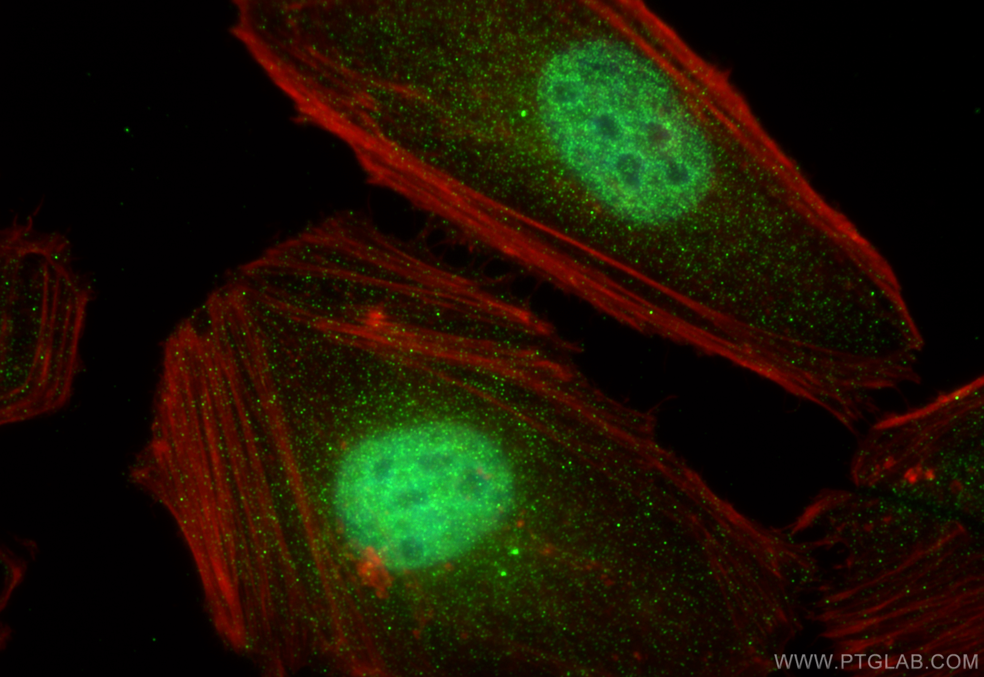 IF Staining of HeLa using 18943-1-AP