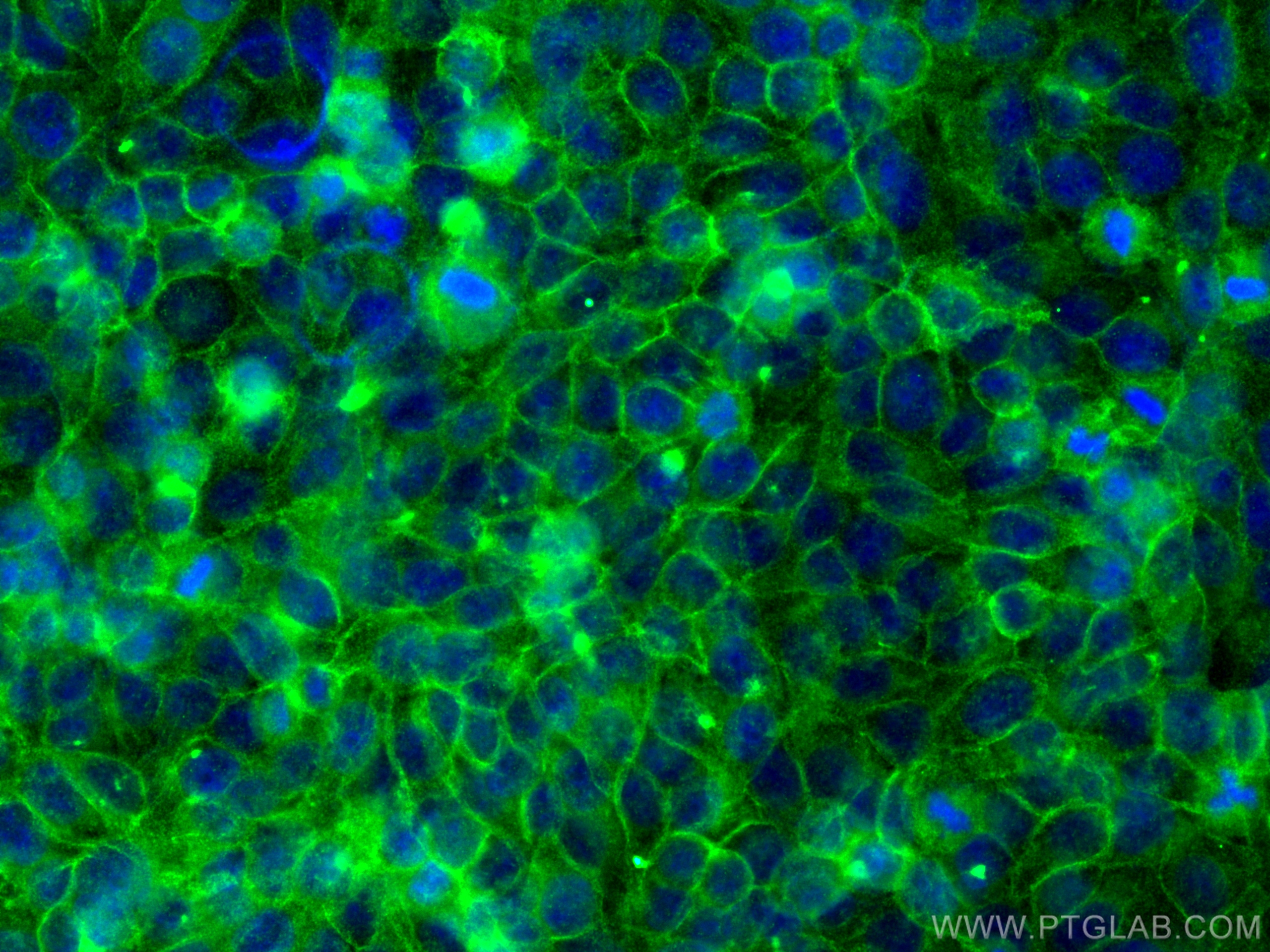 IF Staining of HepG2 using 19548-1-AP