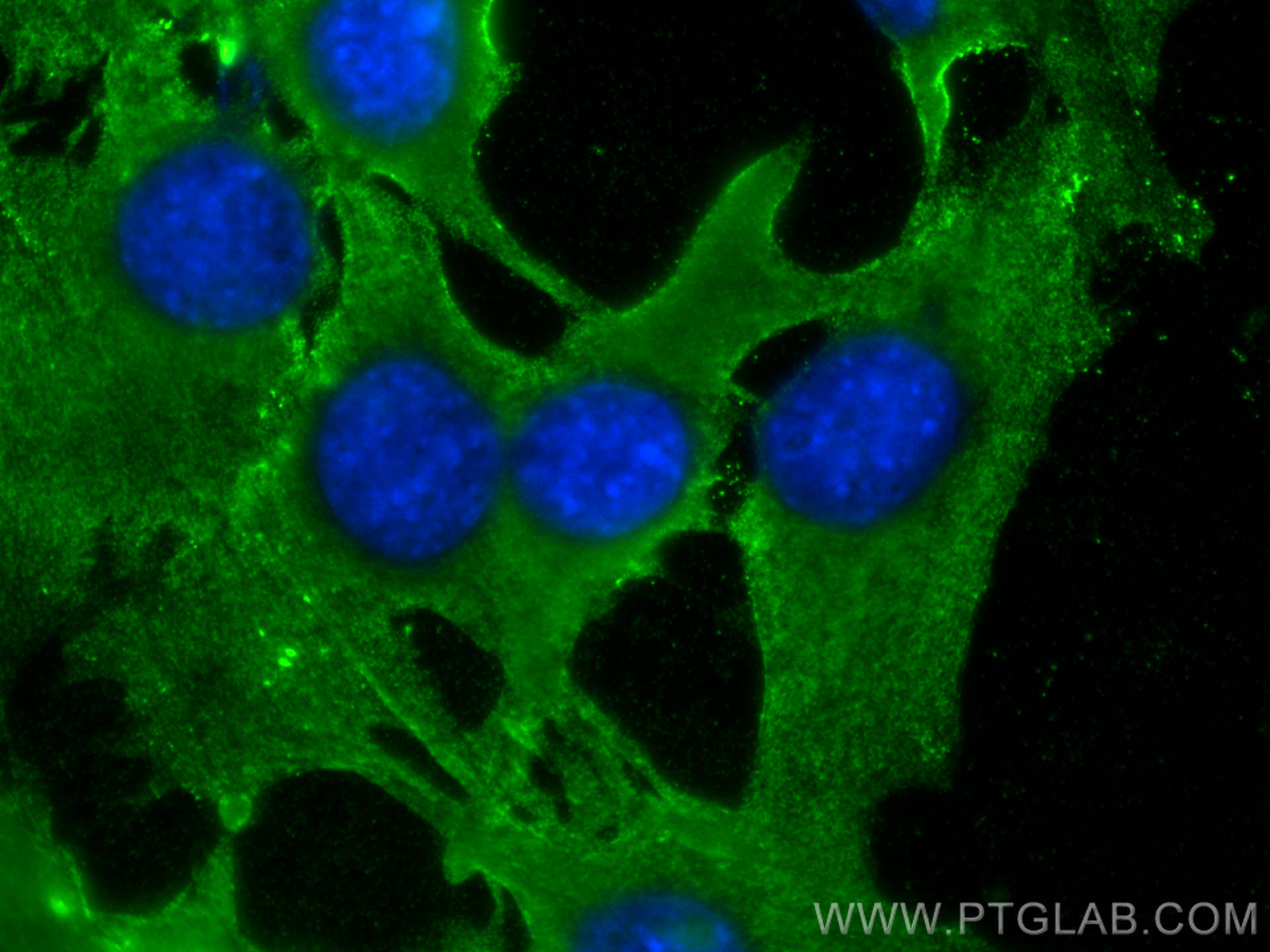 IF Staining of C2C12 using 20360-1-AP