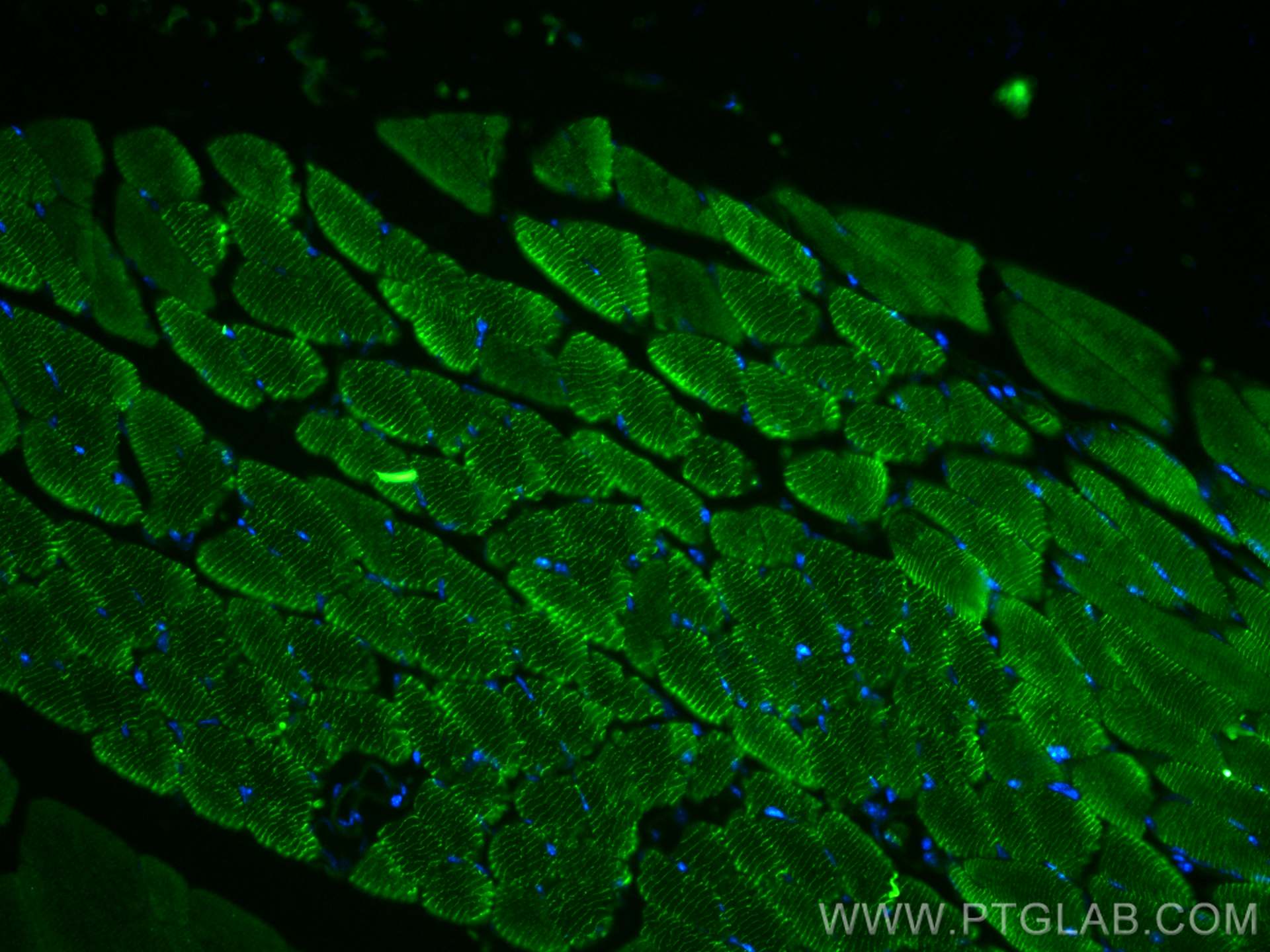 IF Staining of mouse skeletal muscle using 17692-1-AP