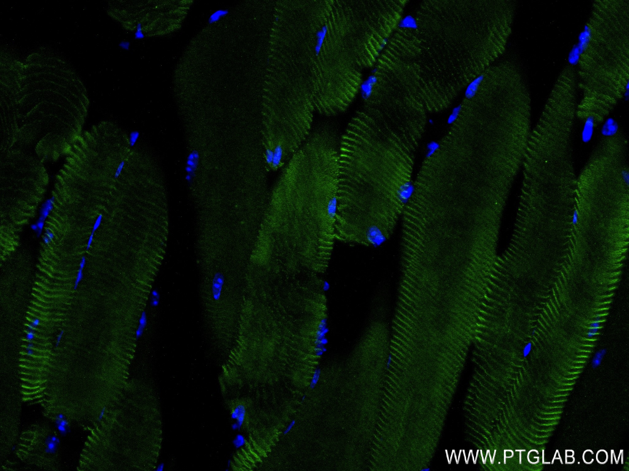 IF Staining of mouse skeletal muscle using 83852-3-RR