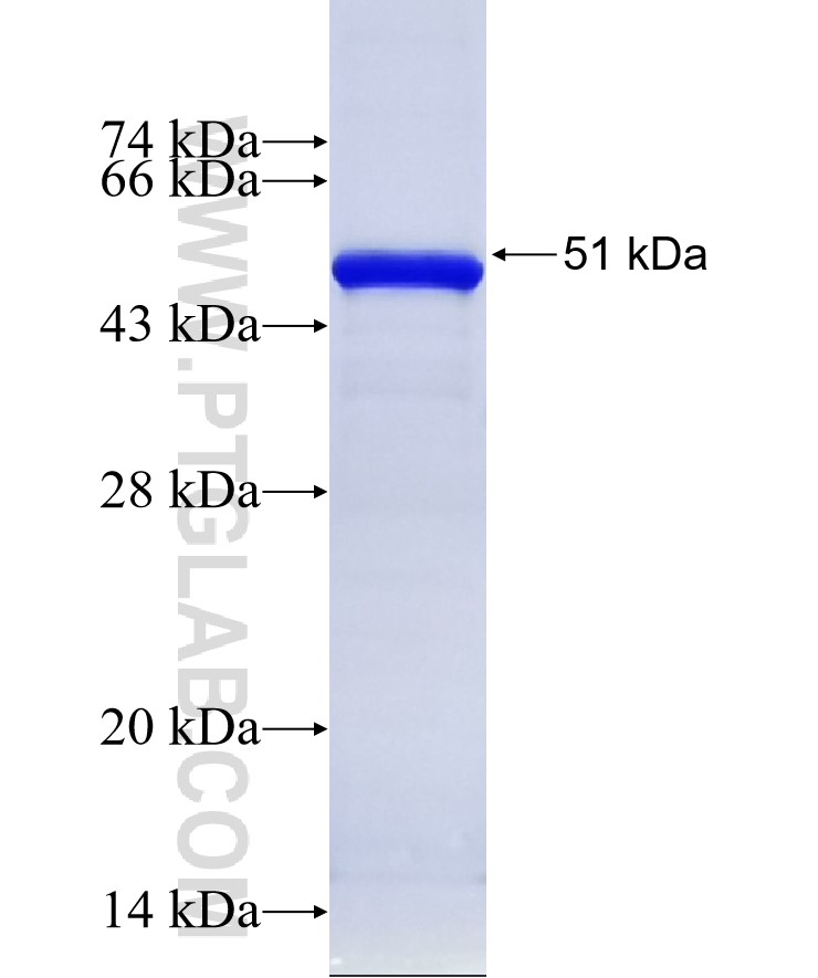 MYOM3 fusion protein Ag11849 SDS-PAGE