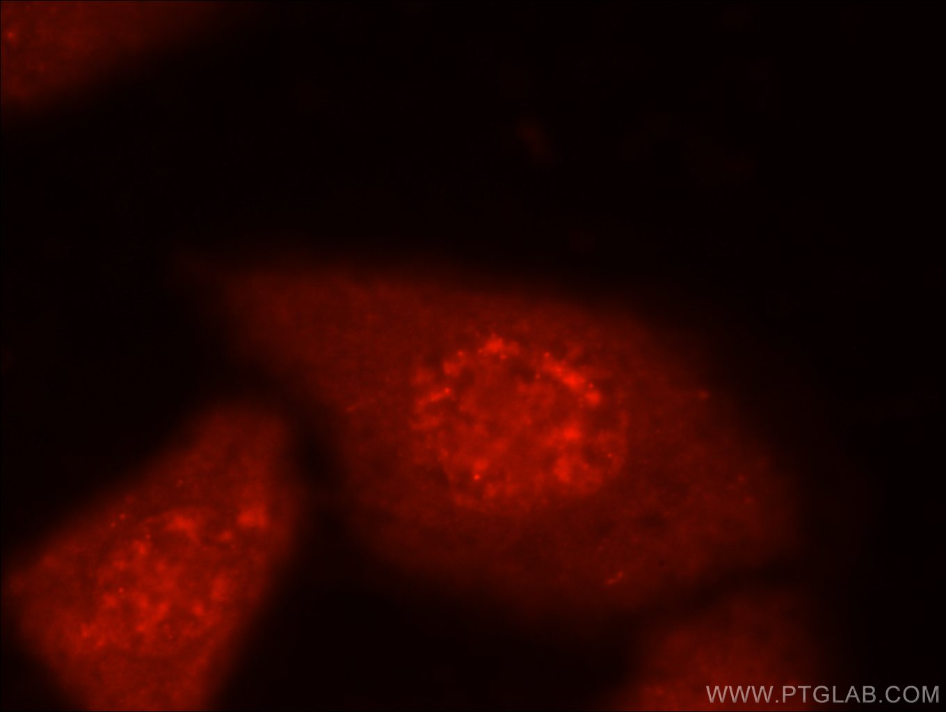 IF Staining of HepG2 using 16180-1-AP