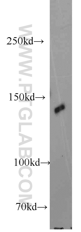 WB analysis of HeLa using 16180-1-AP