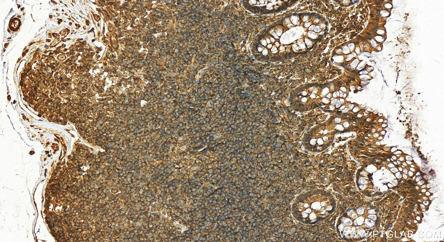 IHC staining of human normal colon using 22117-1-AP