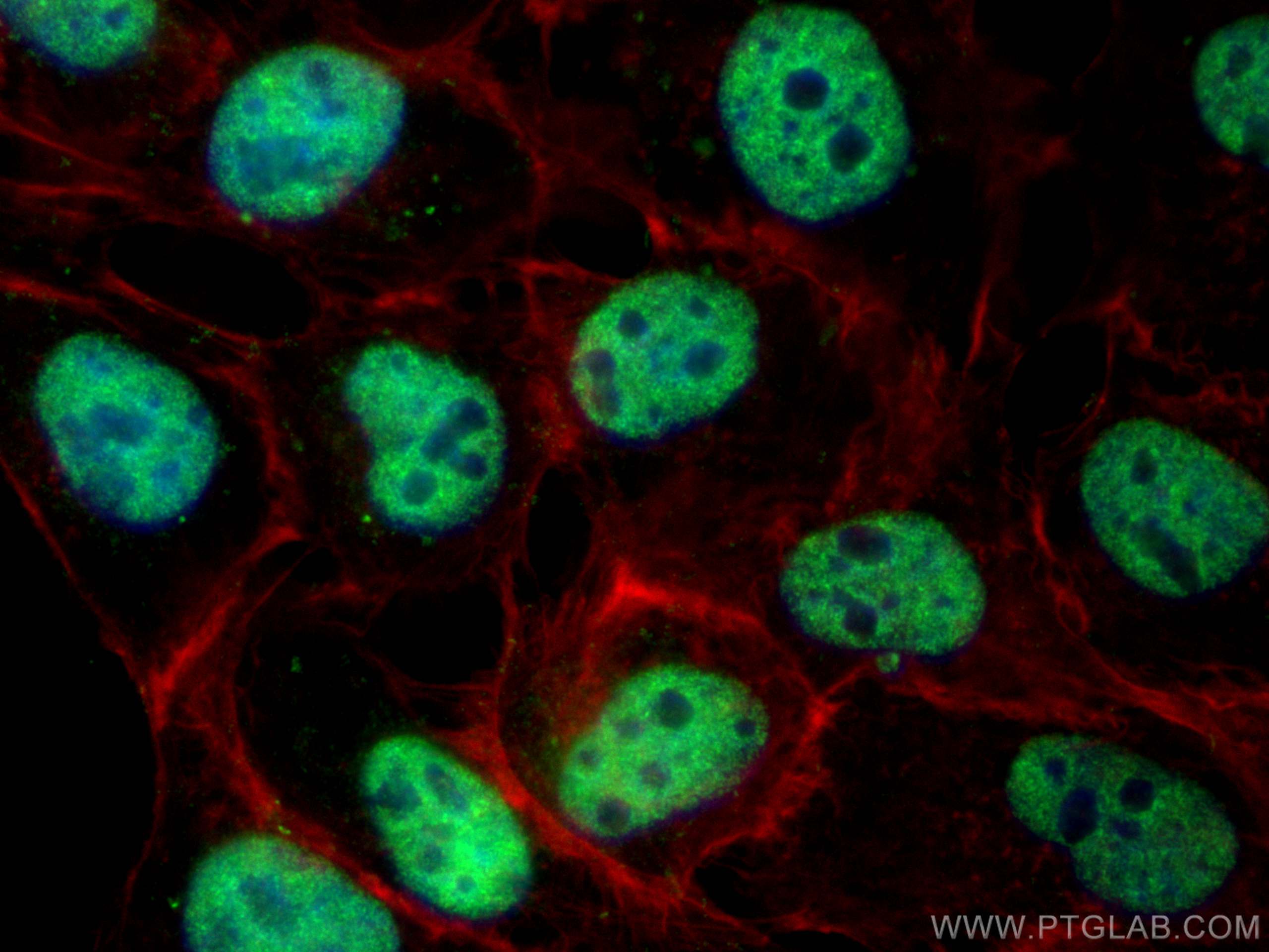 IF Staining of A431 using 20078-1-AP