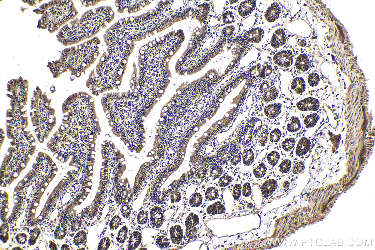 IHC staining of rat small intestine using 20078-1-AP