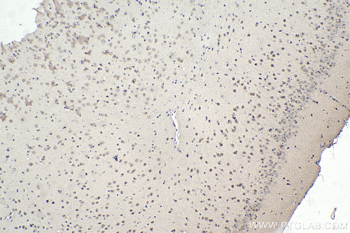 IHC staining of mouse brain using 26204-1-AP