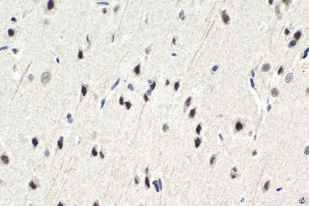 IHC staining of rat brain using 26204-1-AP