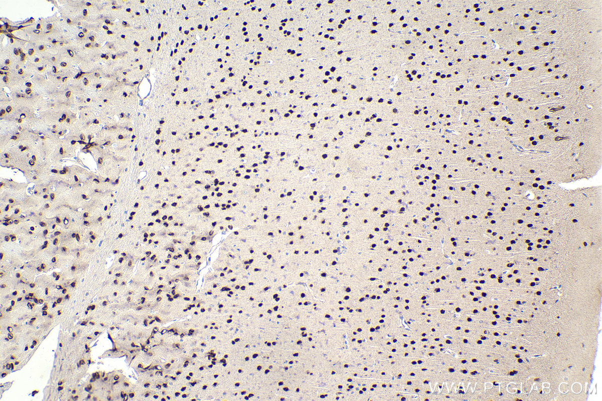 IHC staining of mouse brain using 25234-1-AP