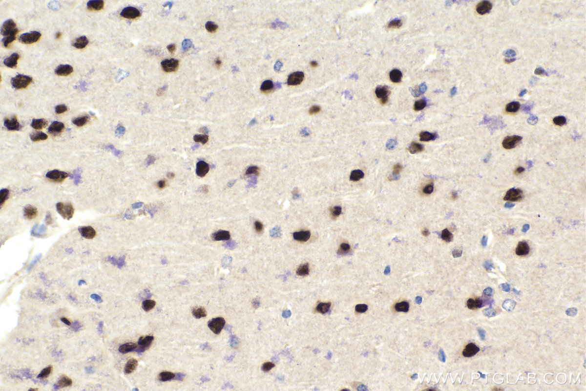 IHC staining of mouse brain using 25234-1-AP