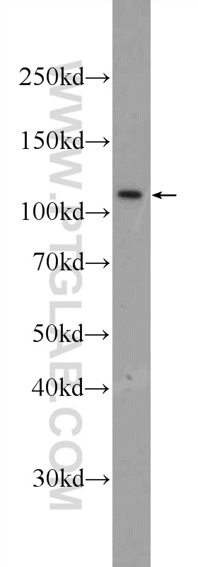 WB analysis of HepG2 using 25234-1-AP