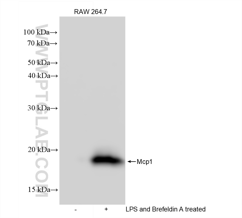 WB analysis of RAW 264.7 using 83157-5-RR