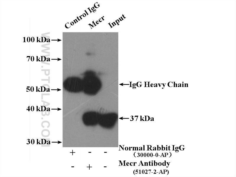 IP experiment of mouse heart using 51027-2-AP