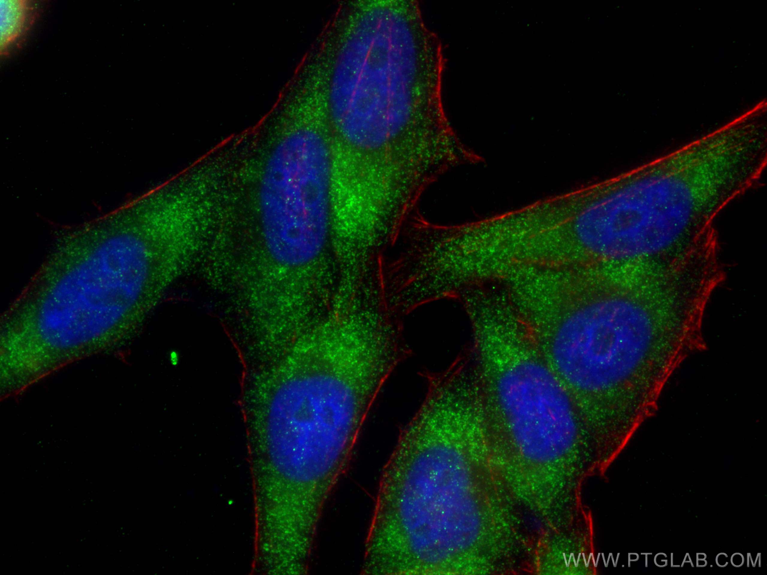 IF Staining of HepG2 using 30145-1-AP