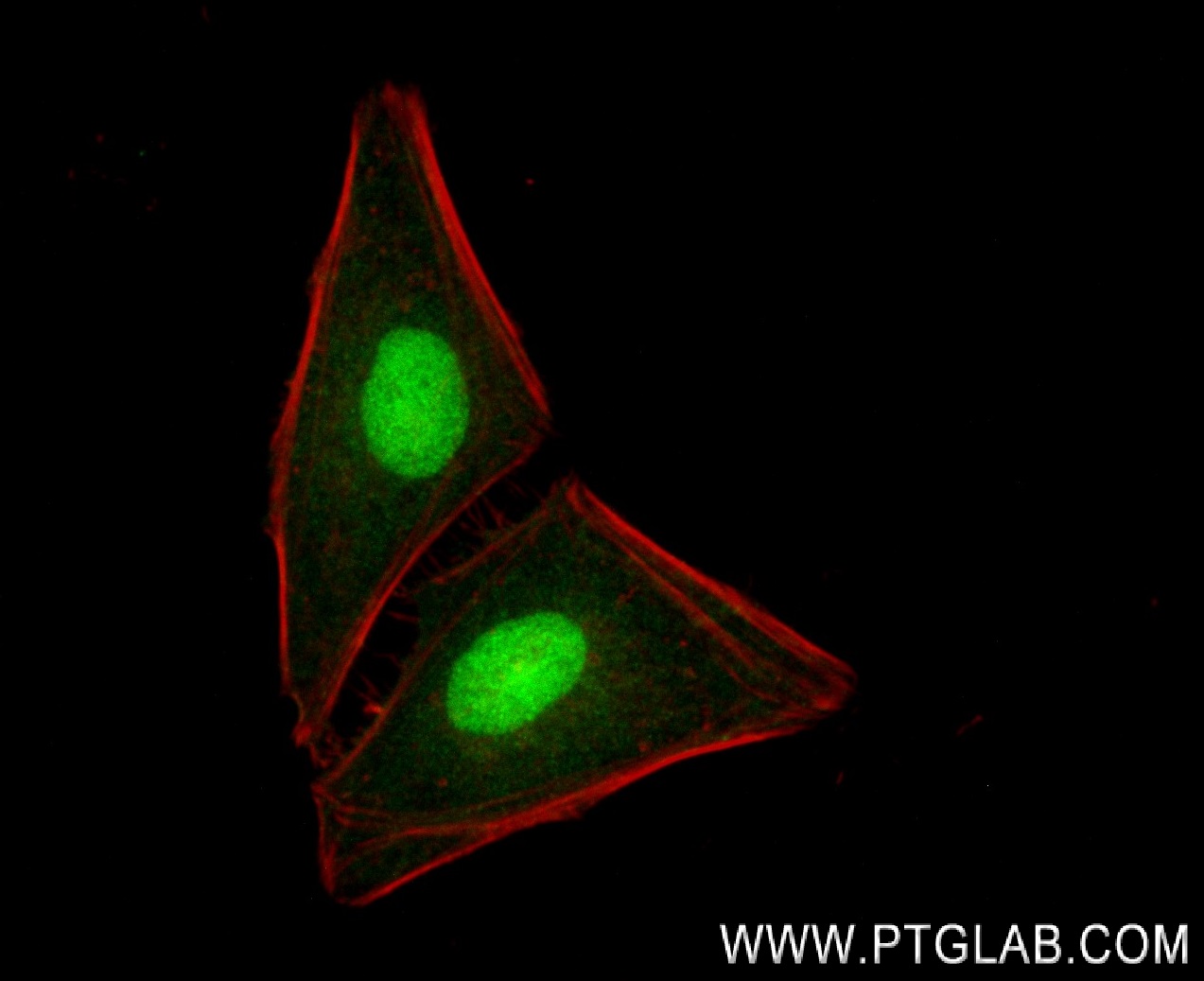 IF Staining of HeLa using 82825-2-RR