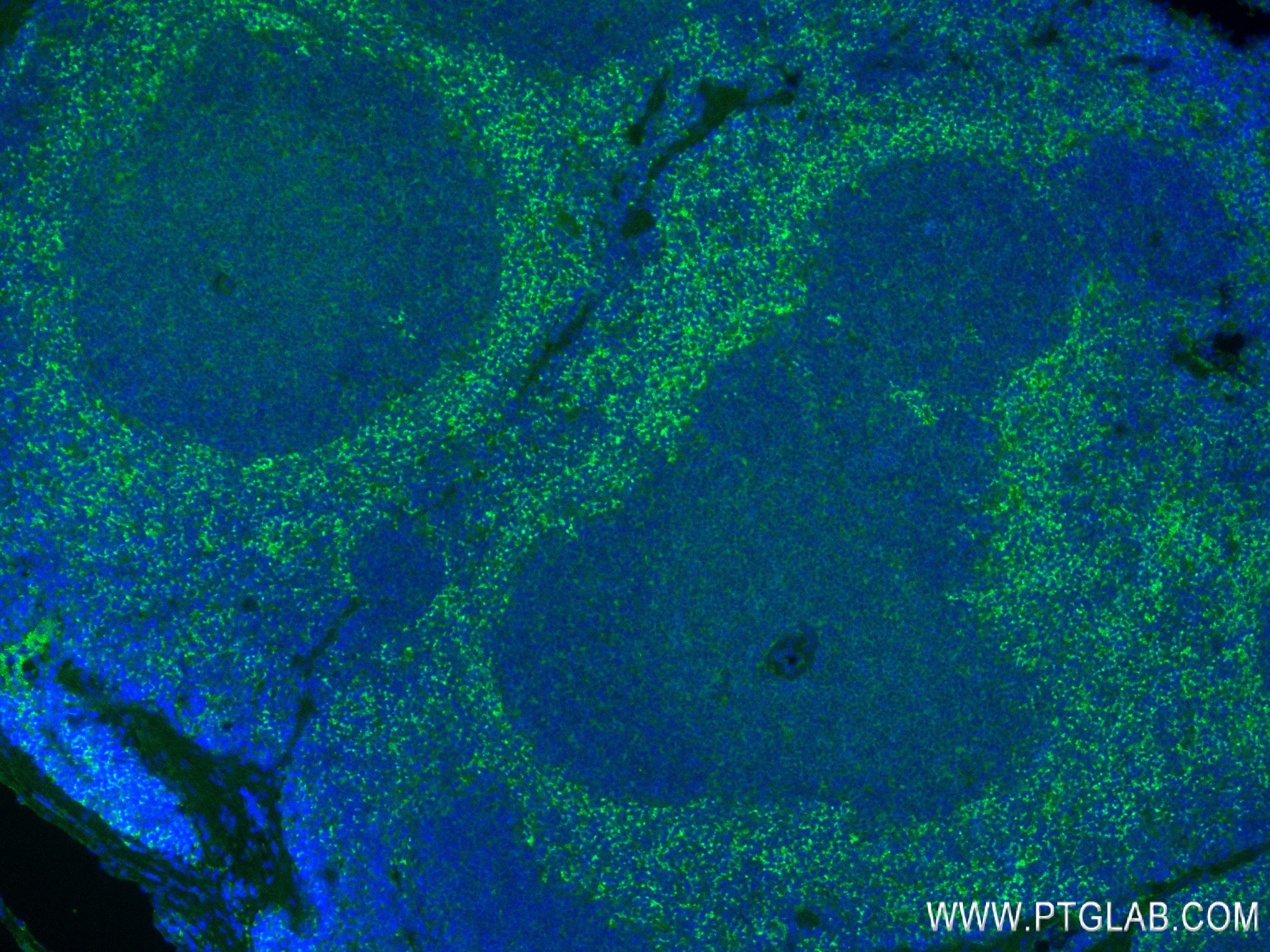 IF Staining of mouse spleen using 84436-4-RR (same clone as 84436-4-PBS)