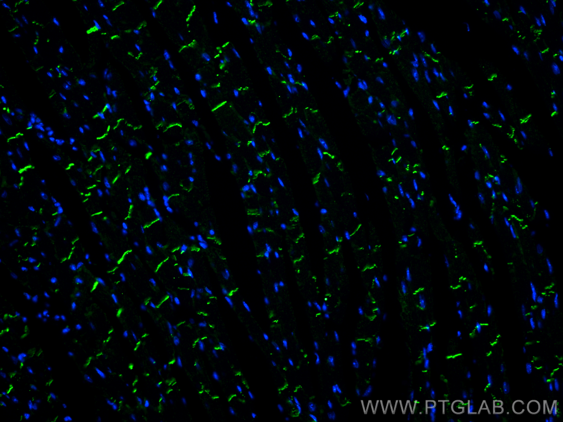 IF Staining of mouse heart using 66219-1-Ig