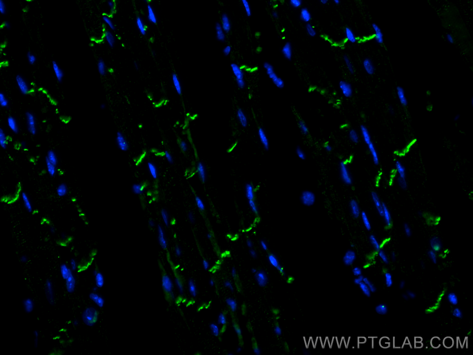 IF Staining of mouse heart using 66219-1-Ig