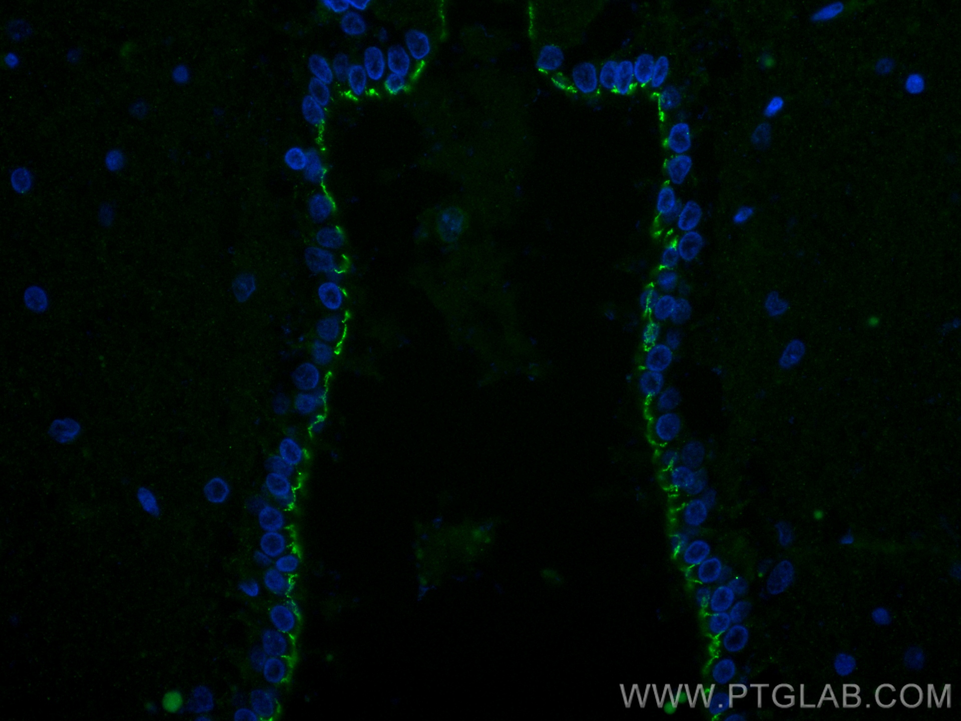 IF Staining of rat brain using 82968-1-RR (same clone as 82968-1-PBS)