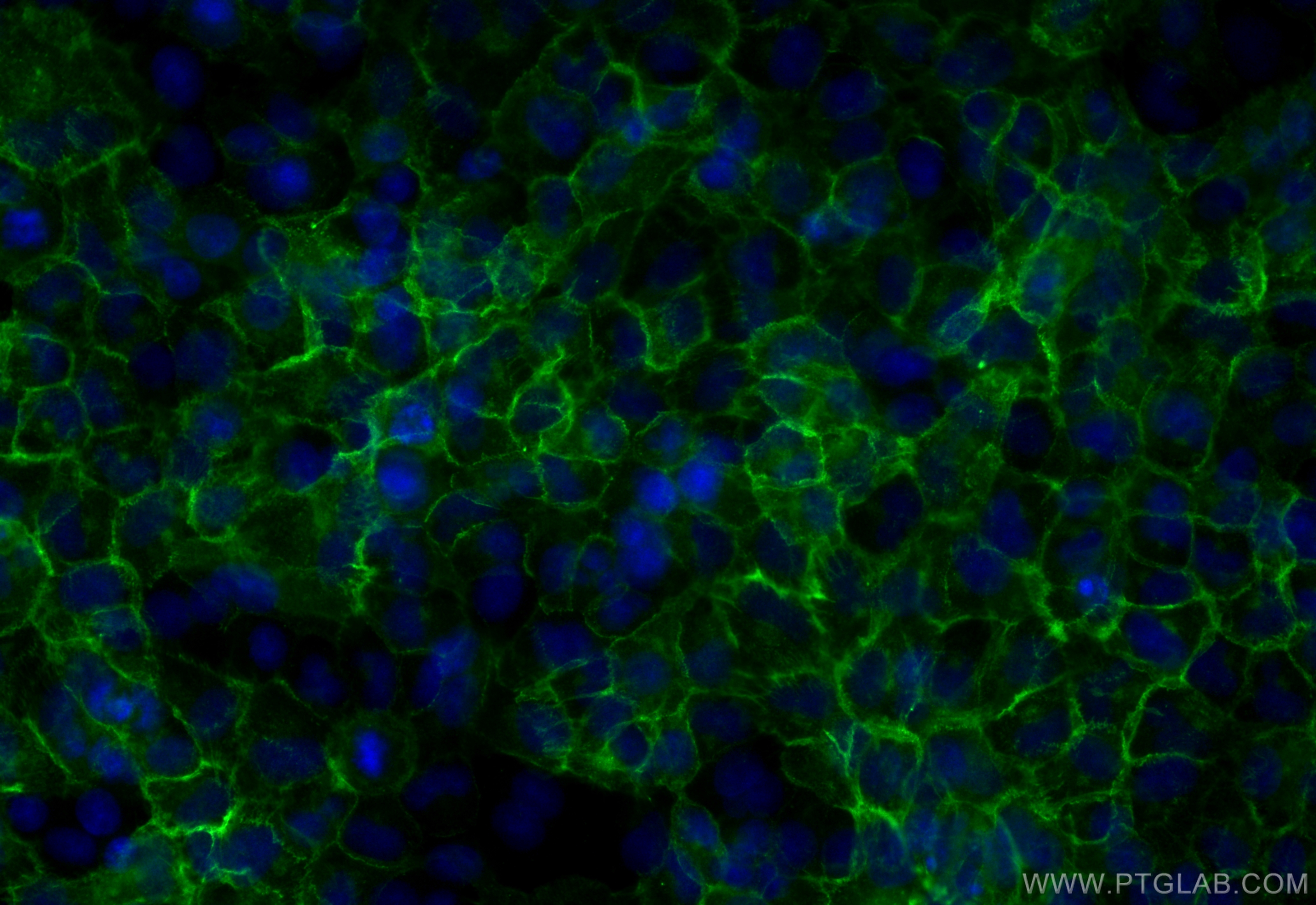 IF Staining of A549 using 82968-1-RR