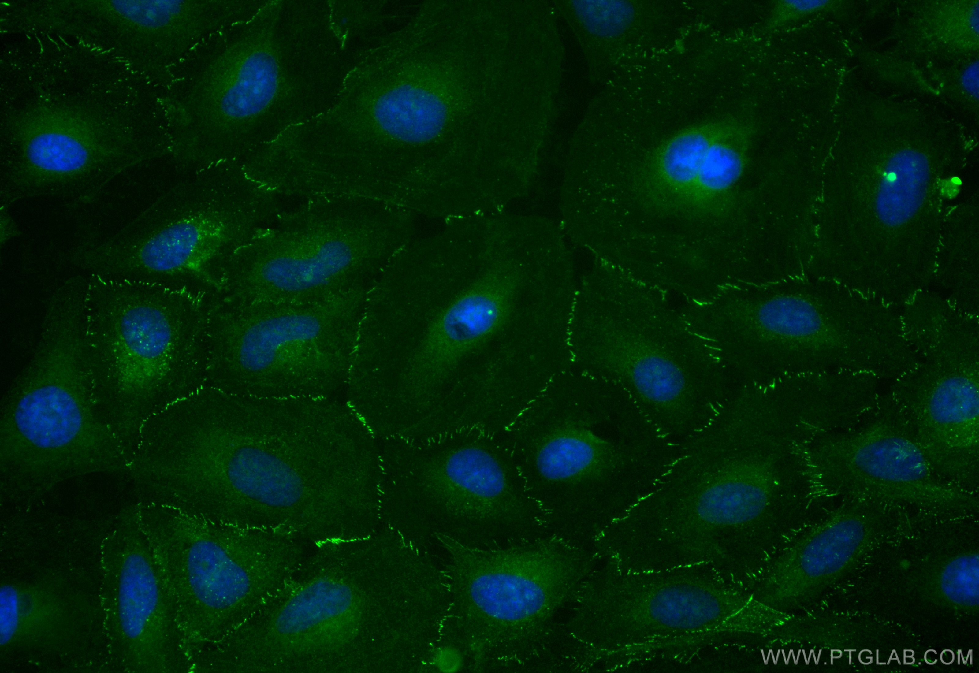 IF Staining of HeLa using CL488-82968