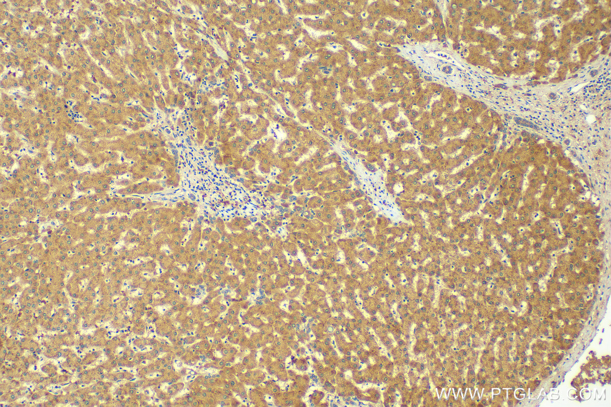 IHC staining of human liver using 83178-2-RR