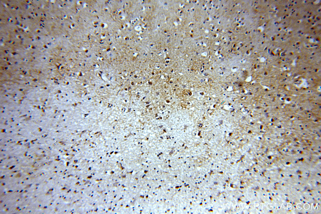 IHC staining of human brain using 19601-1-AP