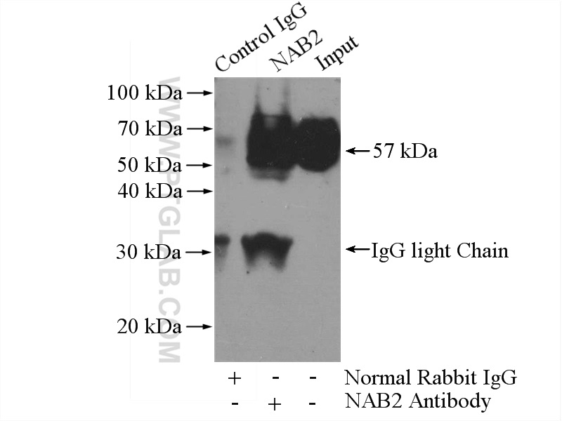 IP experiment of K-562 using 19601-1-AP