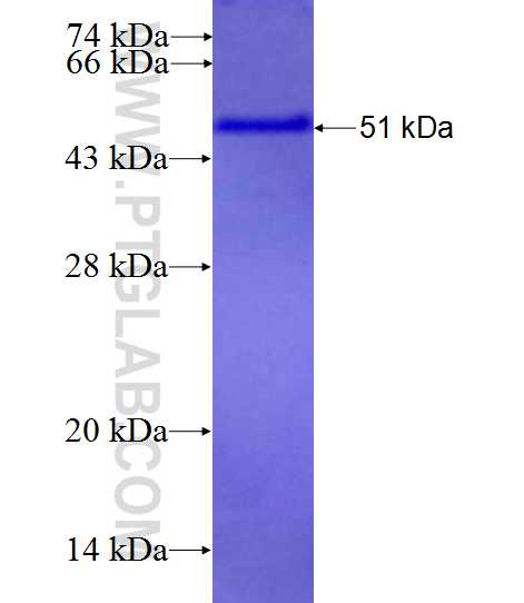 NACC2 fusion protein Ag26874 SDS-PAGE