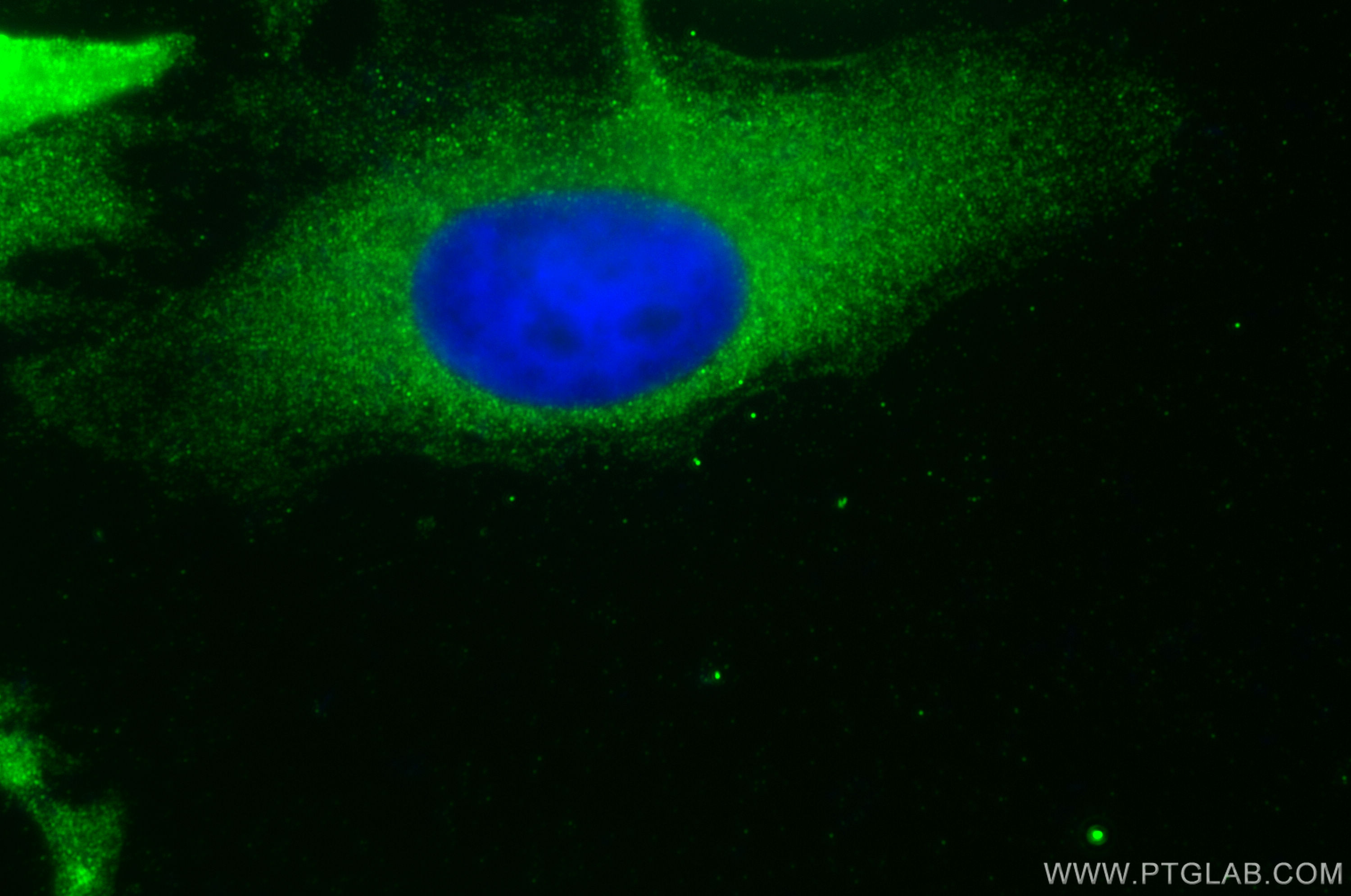 IF Staining of HeLa using 15051-1-AP