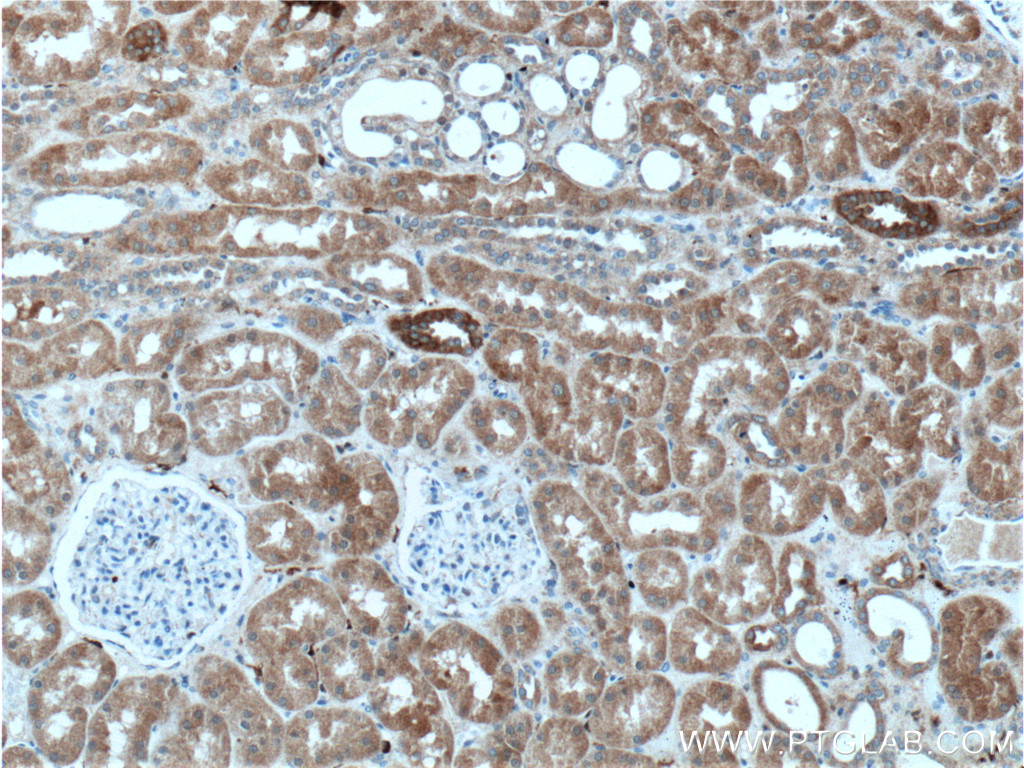 IHC staining of human kidney using 15051-1-AP