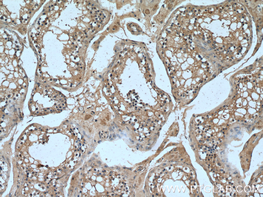 IHC staining of human testis using 21679-1-AP