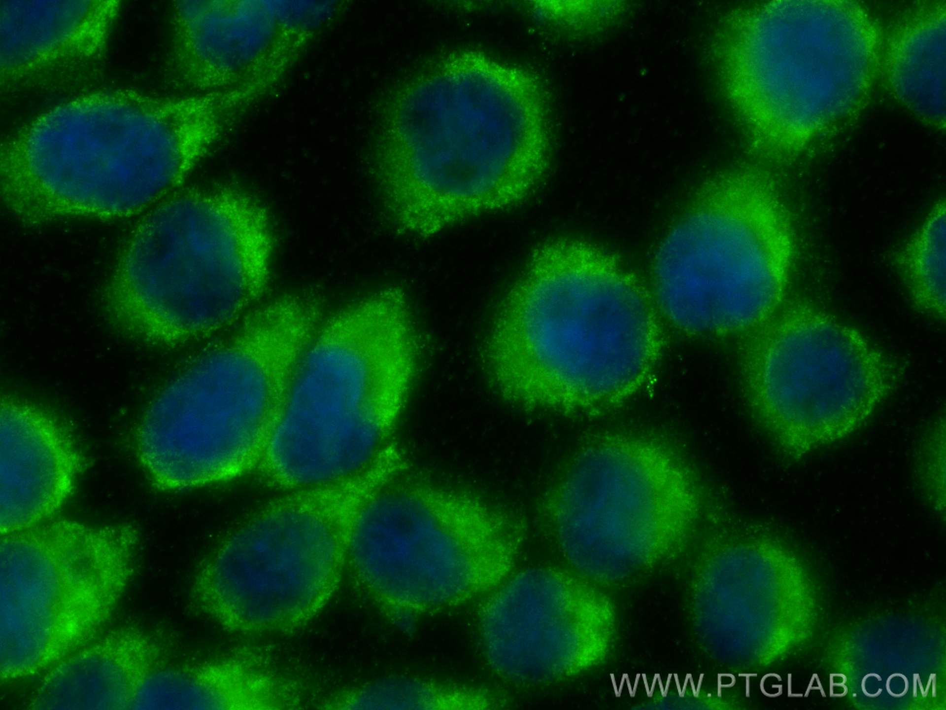 IF Staining of A431 using 12519-1-AP