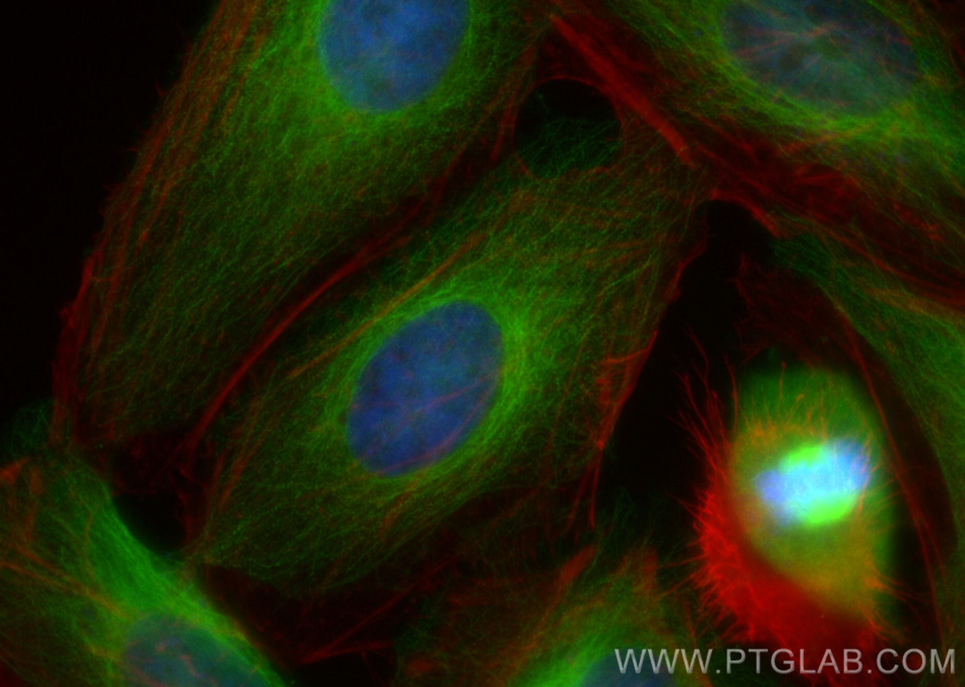 IF Staining of HeLa using 14898-1-AP