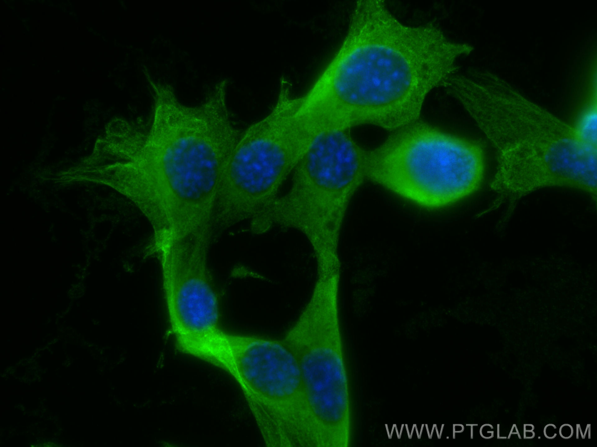 IF Staining of NIH/3T3 using 14898-1-AP