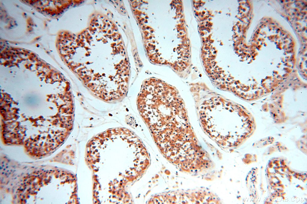 IHC staining of human testis using 14898-1-AP