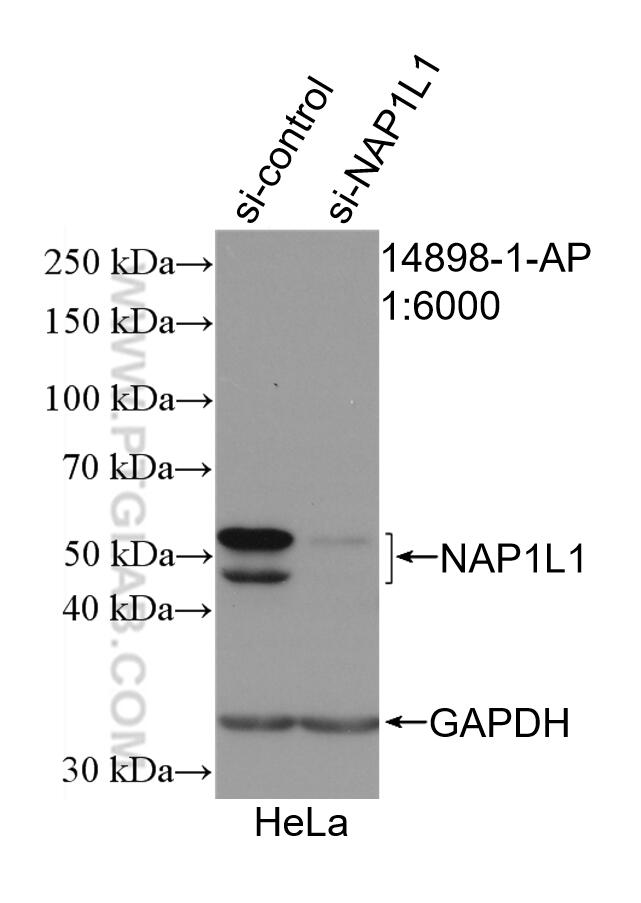 WB analysis of HeLa using 14898-1-AP