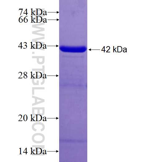 NAP1L2 fusion protein Ag26462 SDS-PAGE