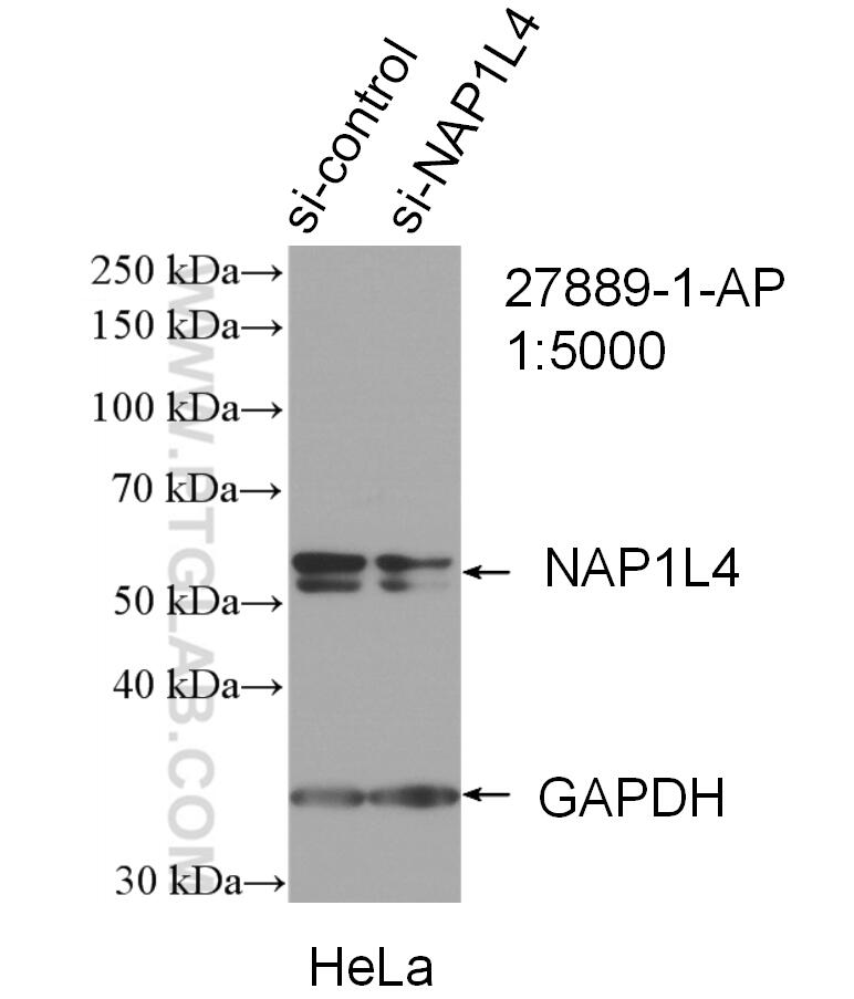 WB analysis of HeLa using 27889-1-AP