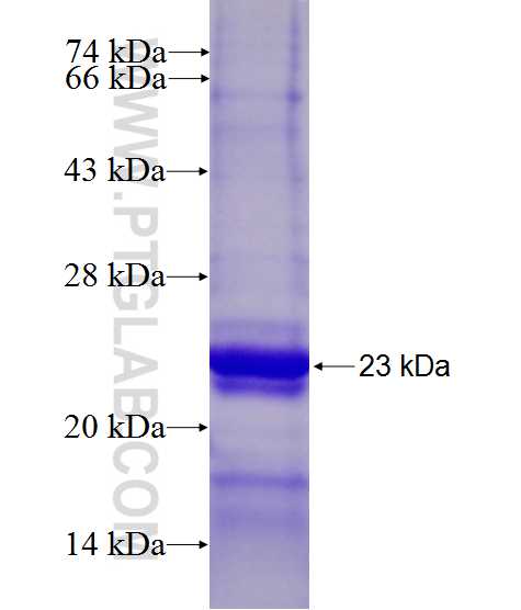 NAP1L4 fusion protein Ag27413 SDS-PAGE