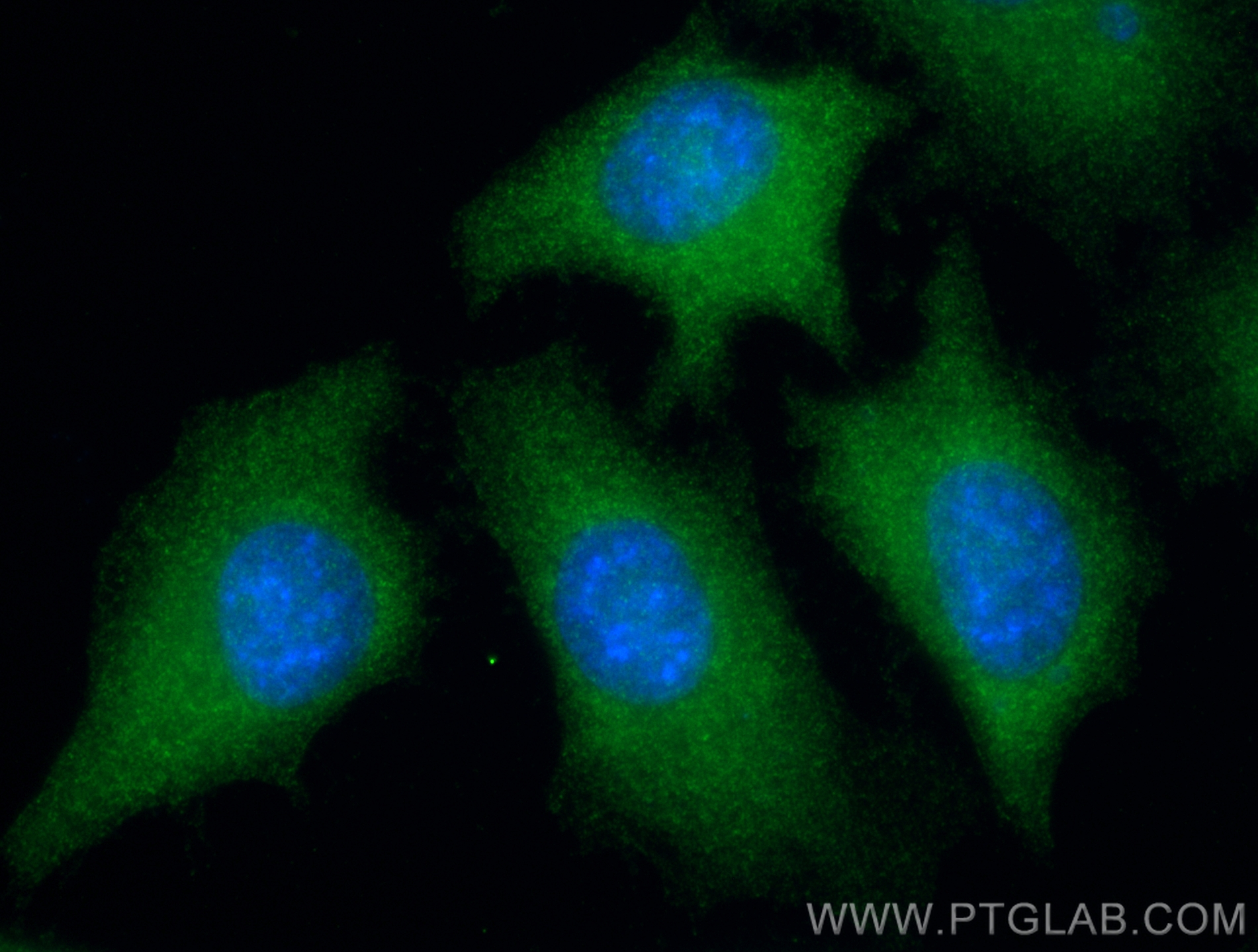 IF Staining of HeLa using 66159-1-Ig