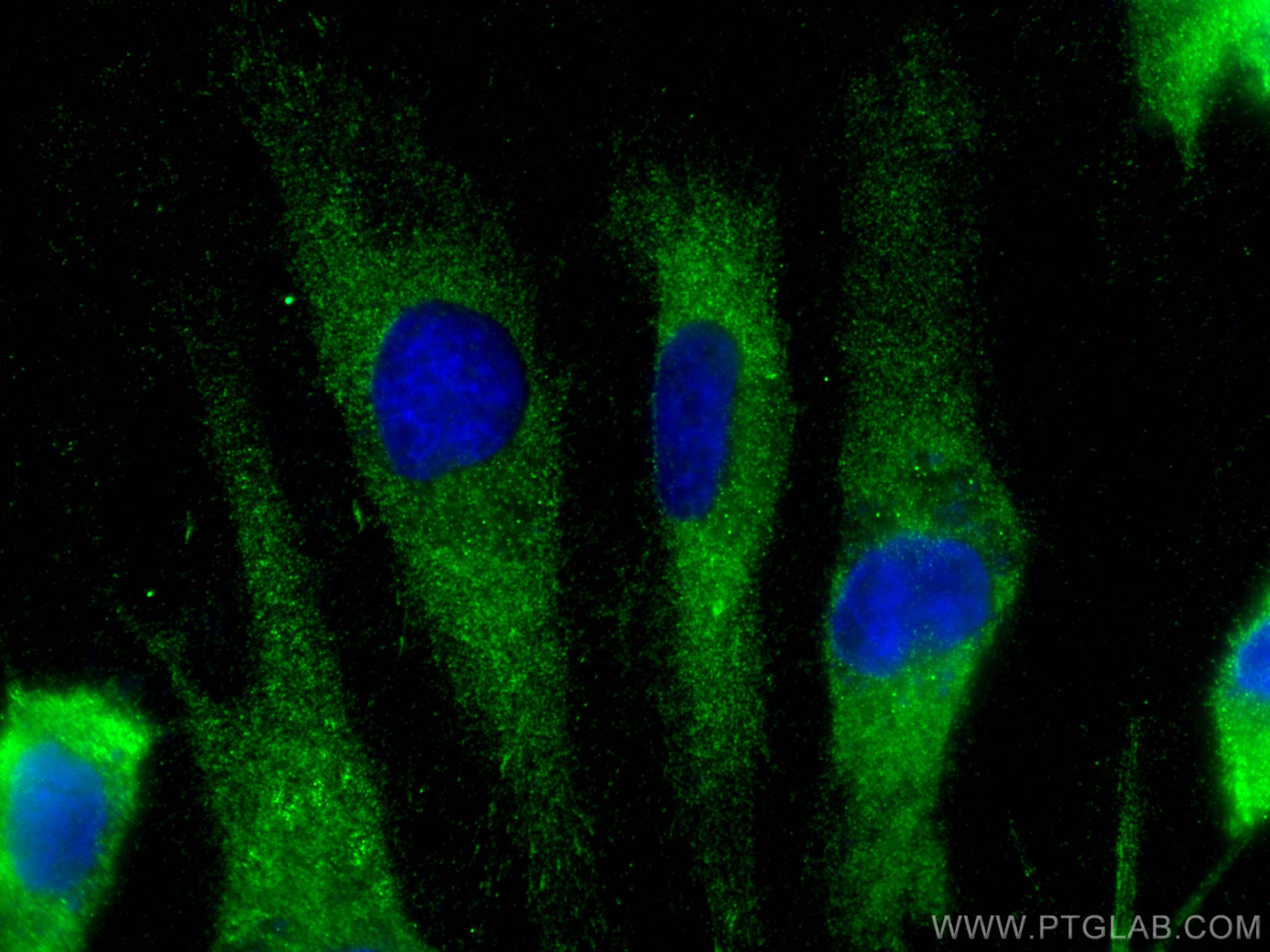 IF Staining of HUVEC using 16558-1-AP