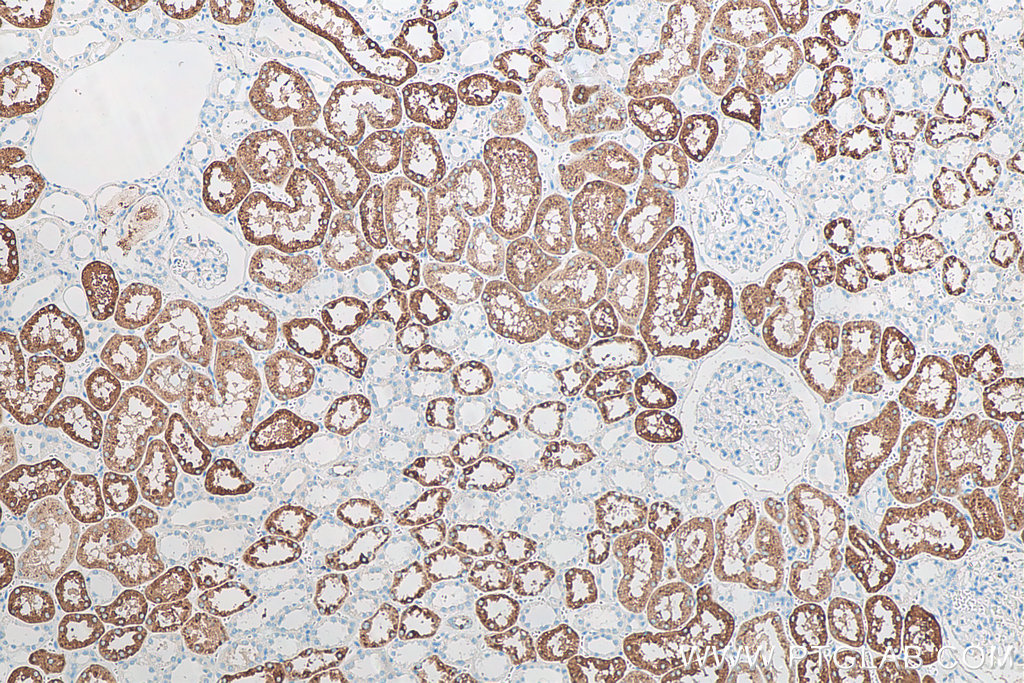 IHC staining of human kidney using 60259-2-Ig