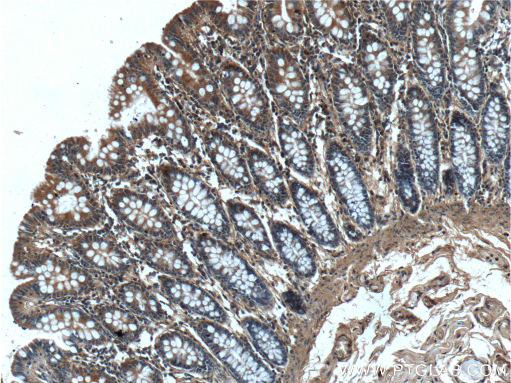 IHC staining of human colon using 13652-1-AP