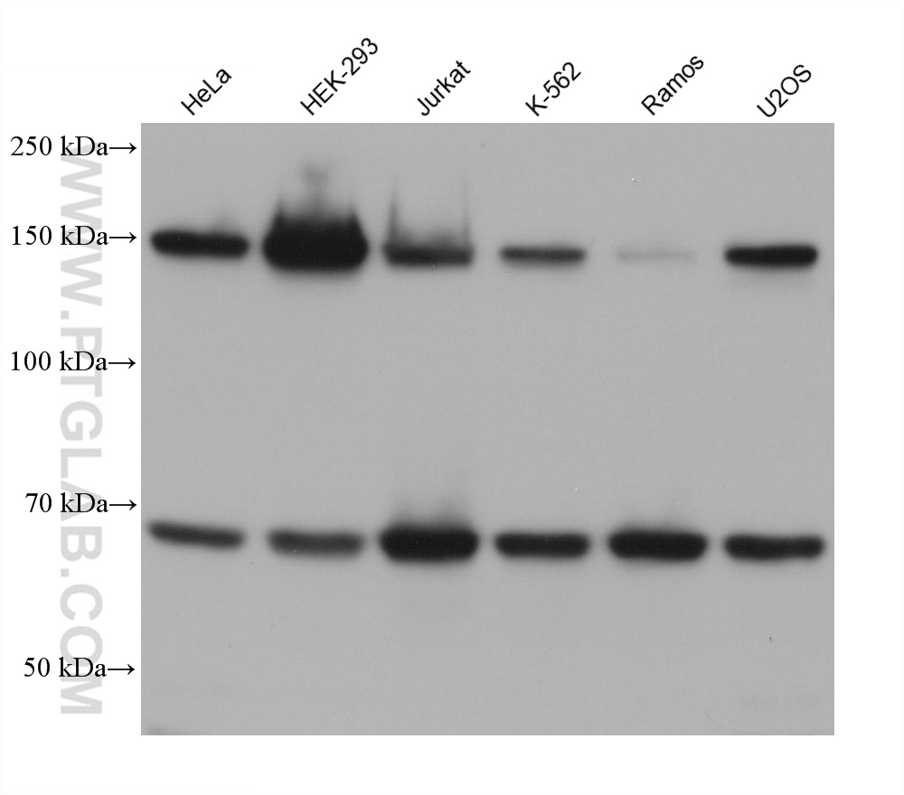 WB analysis using 68710-1-Ig (same clone as 68710-1-PBS)