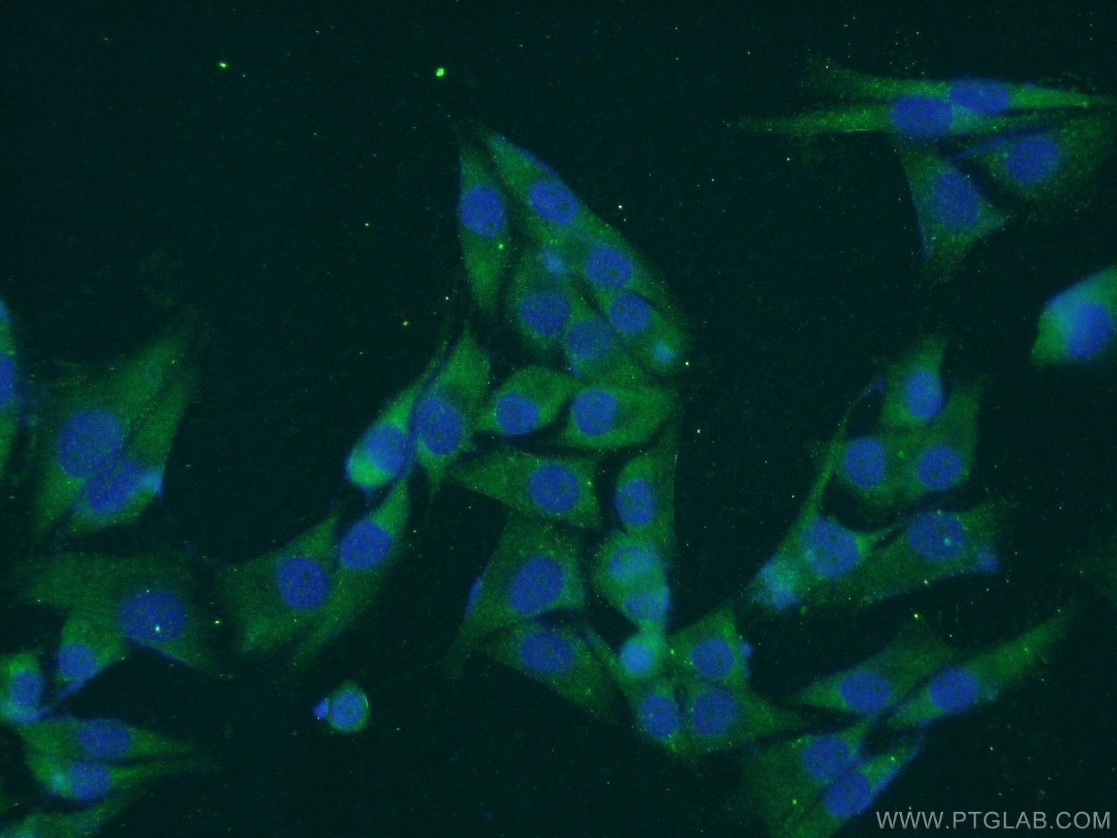 IF Staining of A375 using 14394-1-AP