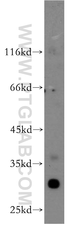 WB analysis of A375 using 14394-1-AP